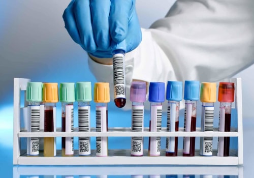 Understanding the Distinction Between Medical Diagnostic Tests and Screening Tests